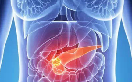 【Natural 子刊】新的辅助手段！最新研究解密胰腺癌敏感机制，提高化疗效果