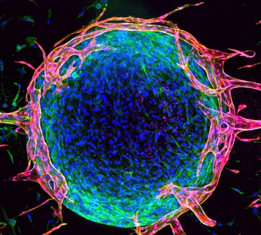 【Nature子刊】浙江大学最新研究：提高癌症免疫治疗的有效策略