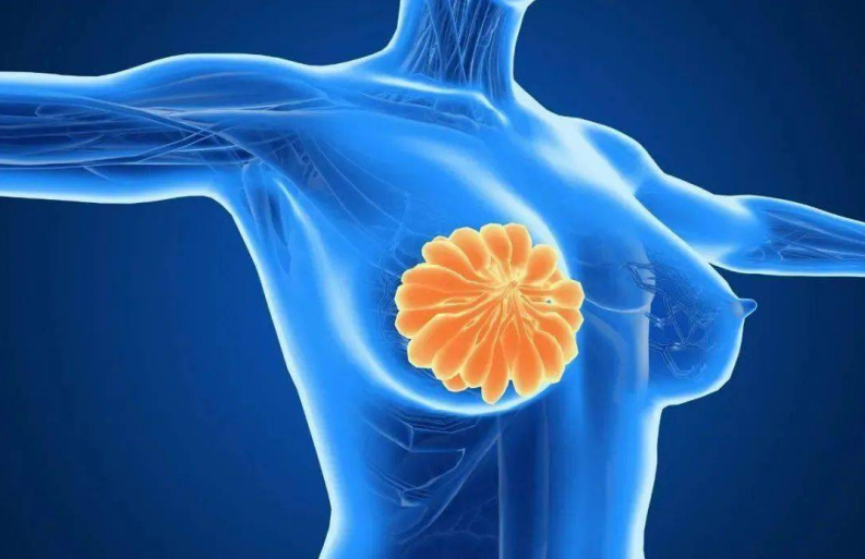 最新！中山大学发现乳腺癌曲妥珠单抗耐药性的调控新机制 揭示治疗新靶点