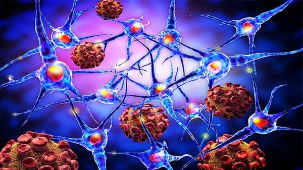 最新！四川大学华西医院研究发现：促进肿瘤复发和转移新机制