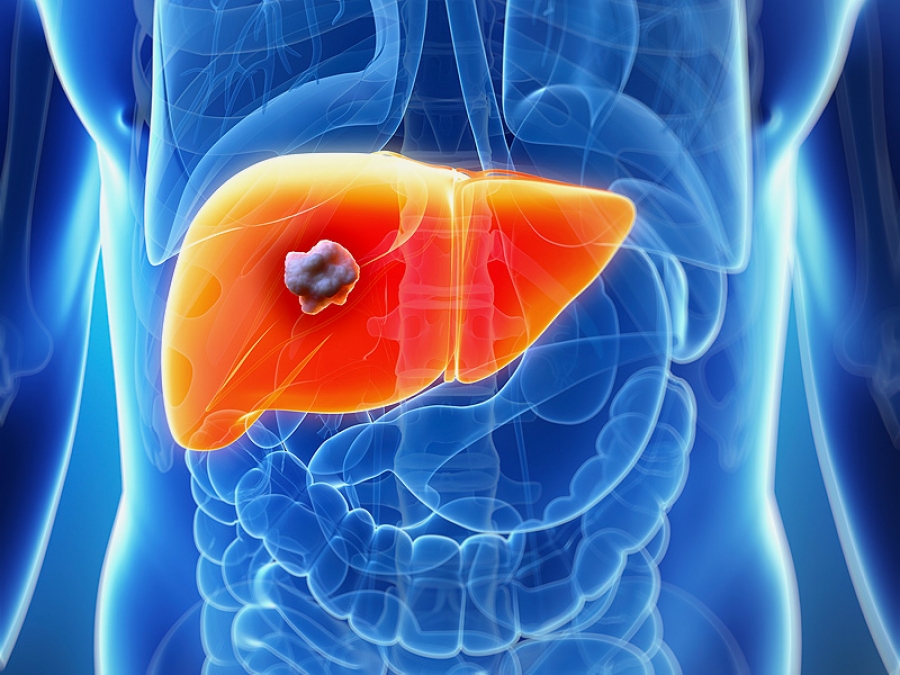 重要发现！四川大学华西医院发现肝内胆管癌的治疗新靶点和预后生物标志物