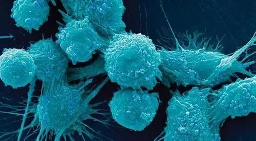 【Nature 子刊】研究发现克服实体肿瘤治疗耐药性的有效策略
