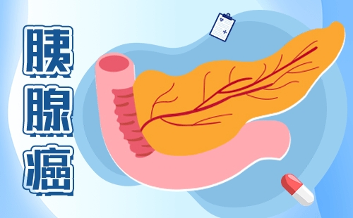 【Cell Discov】上海交大研究团队发现胰腺癌化疗耐药的潜在新机制