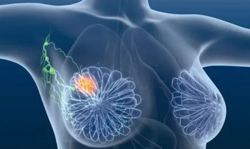 北京协和医学院最新发文：调节“自噬”抑制肿瘤“转移” 实现靶向乳腺癌新靶点