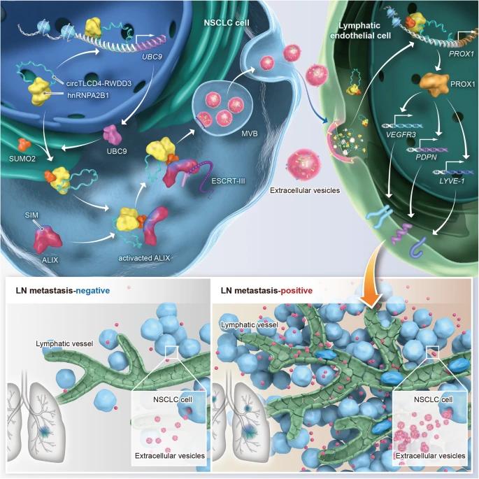 【STTT】北京协和医院联合中山大学研究发现靶向非小细胞肺癌淋巴转移的新机制