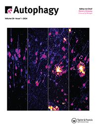 最新！浙江大学梁廷波团队发现通过免疫化疗“根除”胰腺癌的机制