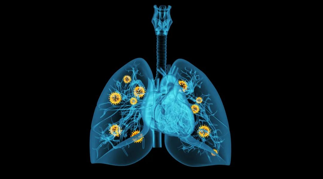 逆转耐药性！暨南大学等团队揭示非小细胞肺癌最新治疗靶点