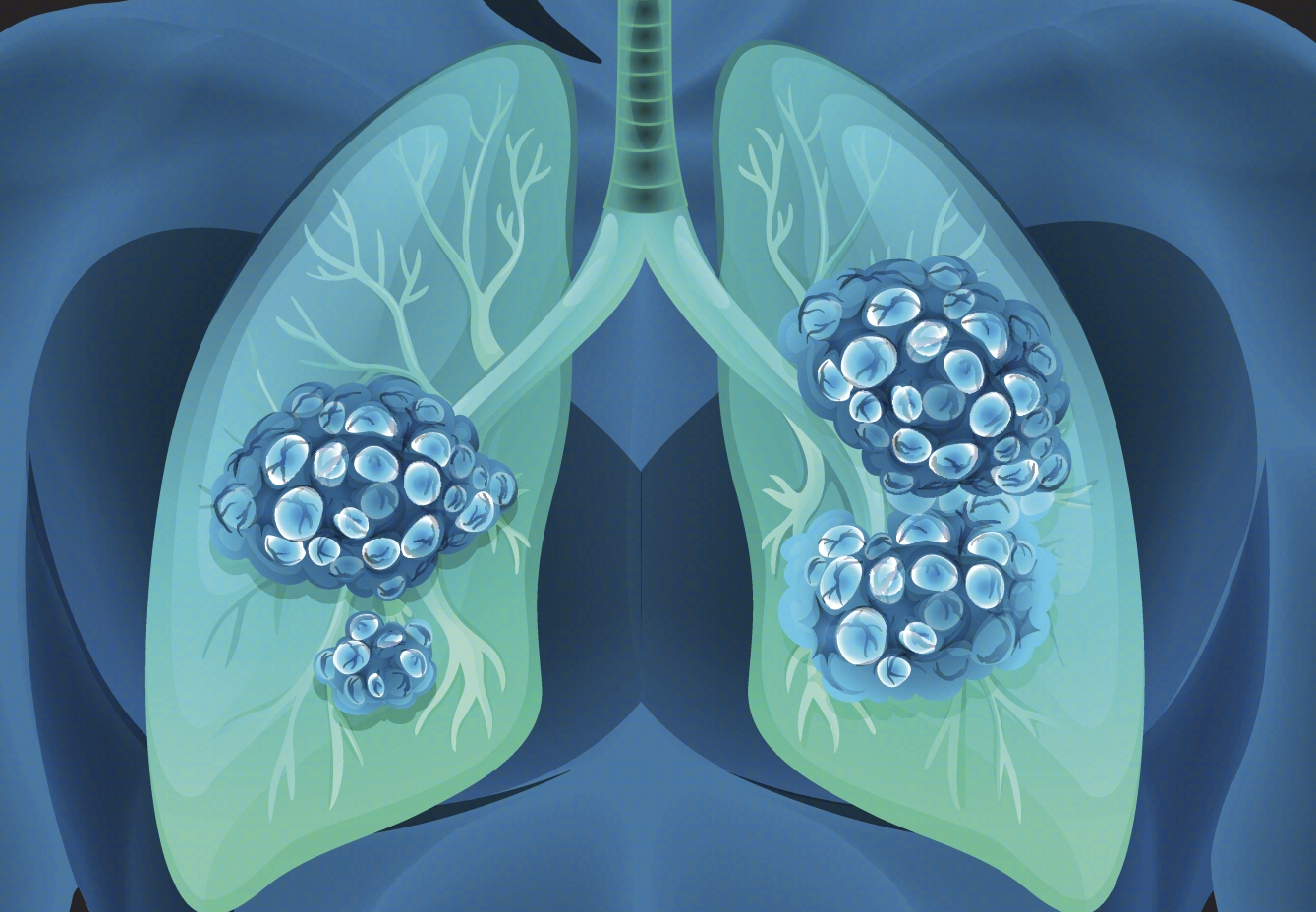 双重靶向！沈阳药科大学发现非小细胞肺癌药物耐药机制和逆转耐药策略
