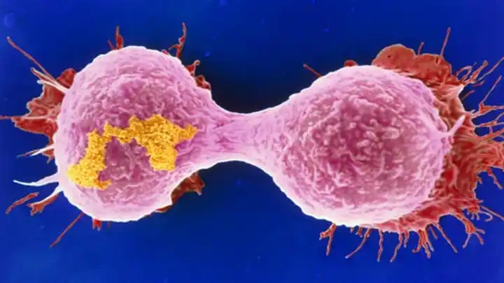 【Cell 子刊】国外学者发文：打破“最毒乳腺癌”免疫耐受的治疗靶点