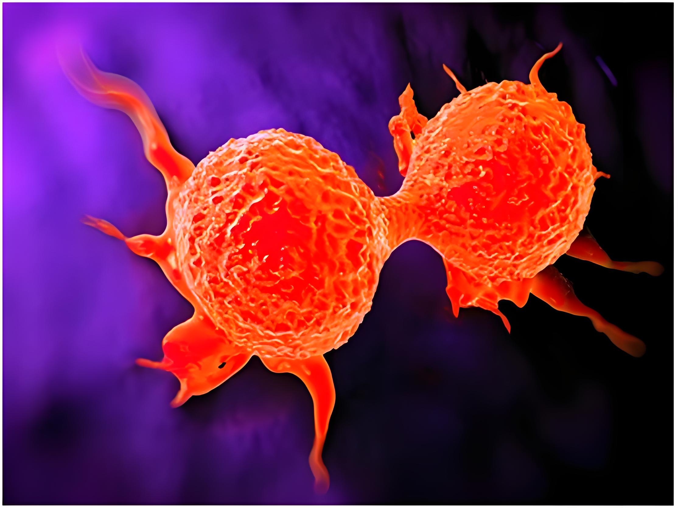 显著增强乳腺癌治疗效果！南方医科大学发文：设计出“光动力凝胶炸弹”