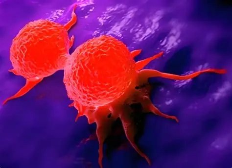 乳腺癌转移有新解！重庆医科大学发现生物标志物与治疗新靶点