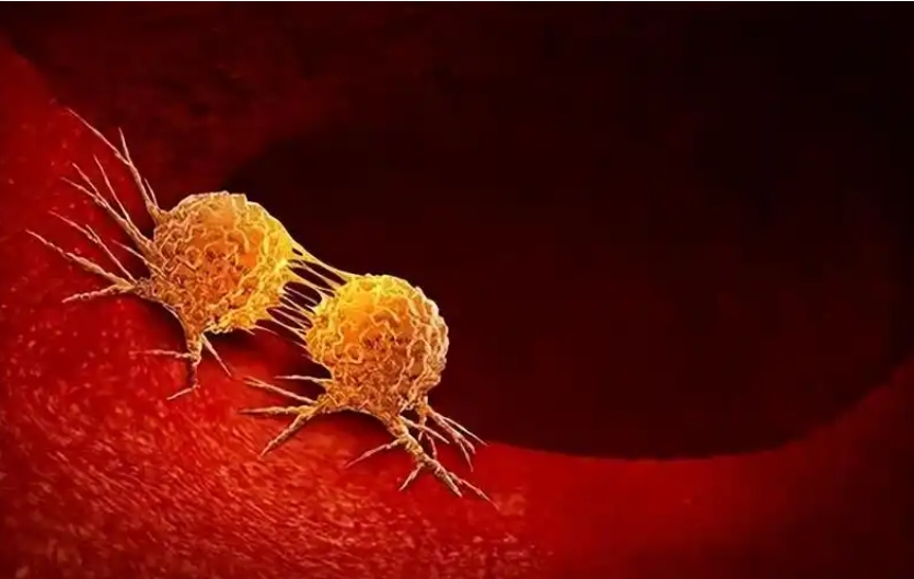 新型调节因子! 武汉大学中南医院：癌症精准治疗新见解