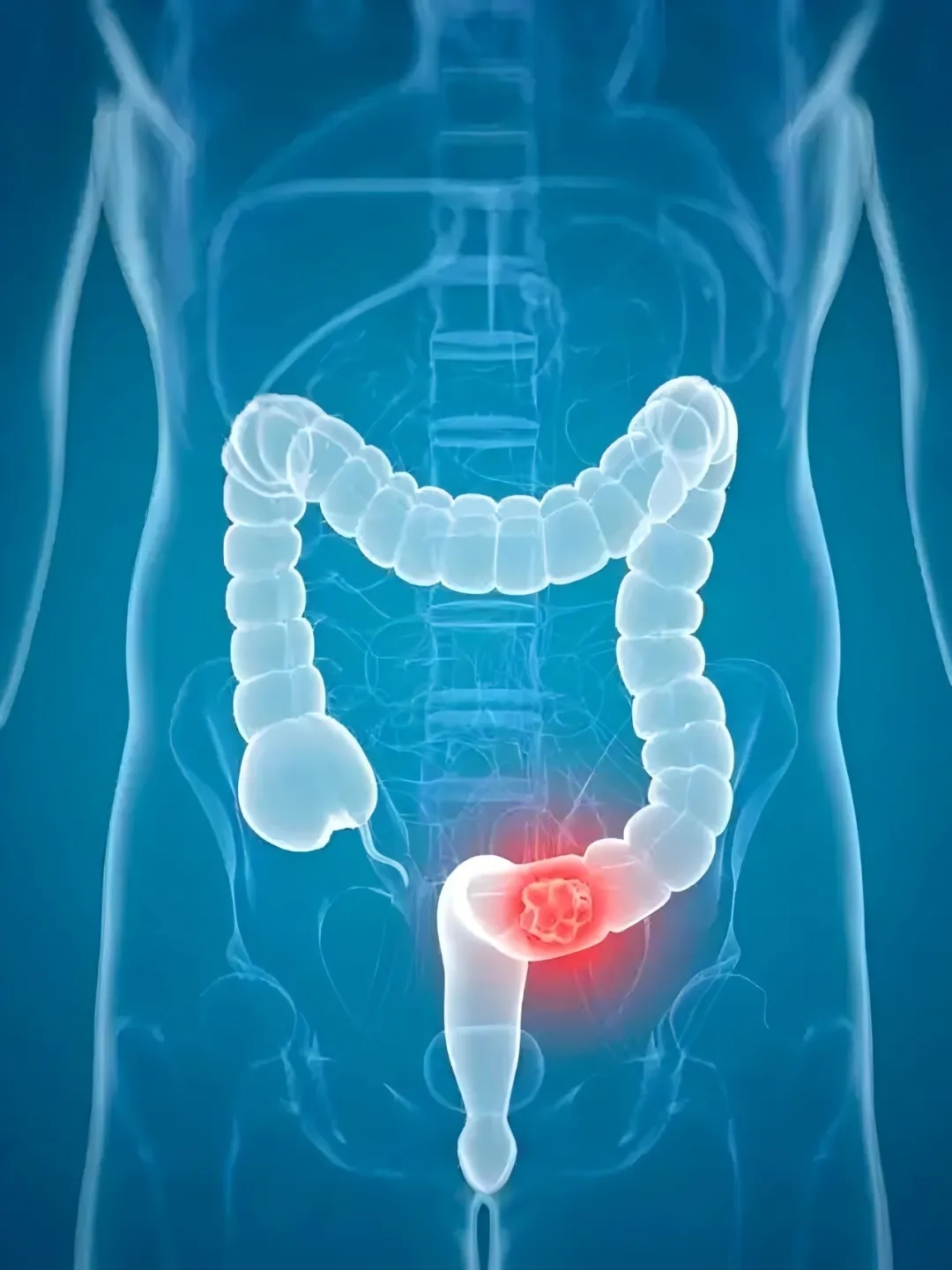 靶向巨噬细胞！南方医科大学南方医院等单位合作发文：改善免疫治疗安全性的潜在策略