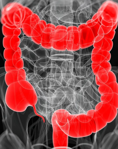 克服应激耐受性！江苏海洋大学等单位合作发文：结直肠癌治疗干预有前景的分子靶点