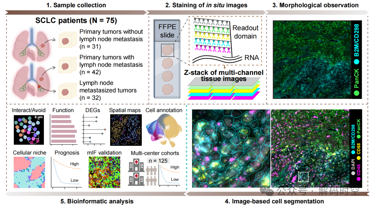 Cell Report Medicine丨CosMx SMI构建首个小细胞肺癌原发与淋巴结转移高分辨率空间单细胞图谱