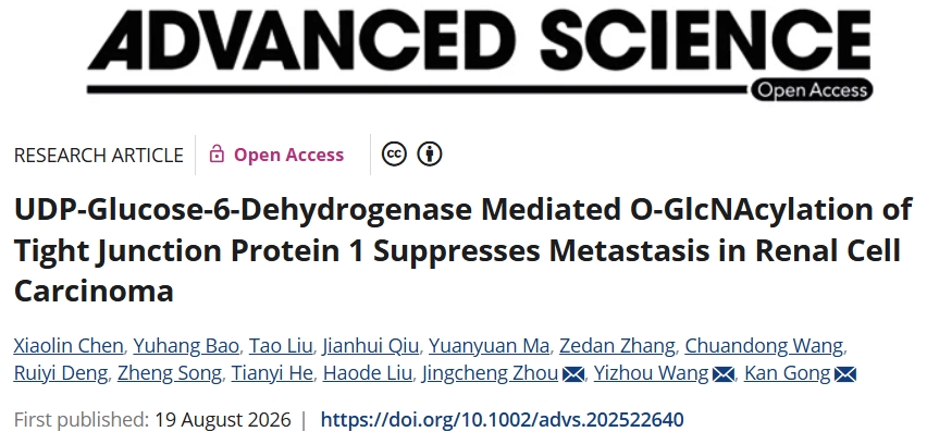 有效阻碍转移！北京大学第一医院发文：利用OSMI-1抑制OGT的新型肾癌治疗策略