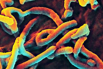 JIDC：早期筛查是避免大型埃博拉疫情爆发的关键