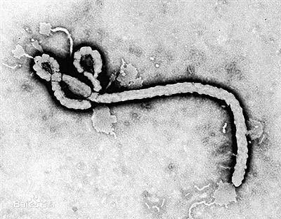 美国确诊本土首例埃博拉 病患在达拉斯被严格隔离