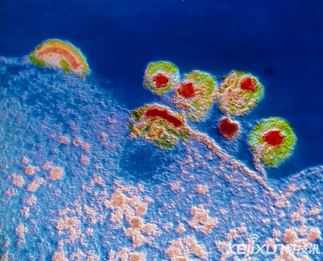 PNAS：中山大学发现天然病毒能感染并杀伤癌细胞