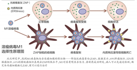 M1“灭癌”病毒下周猴子活体实验