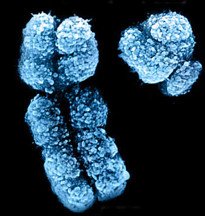 美国人类遗传学年会：Y染色体缺失或增加老年男性个体患癌及死亡风险 