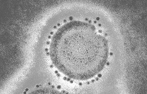 科学家质疑美中止危险性病毒研究会影响流感监测和疫苗研发