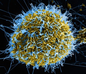 科学家解析甲肝病毒全颗粒晶体結构