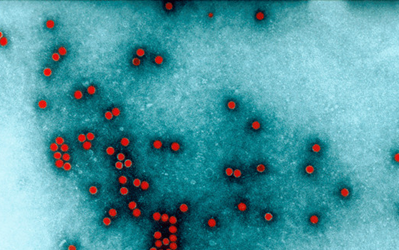 PNAS：抗脊灰病毒疫苗的变异病毒已被发现
