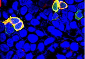 Diabetes：Sestrin 3蛋白或可成为控制糖尿病的新靶标