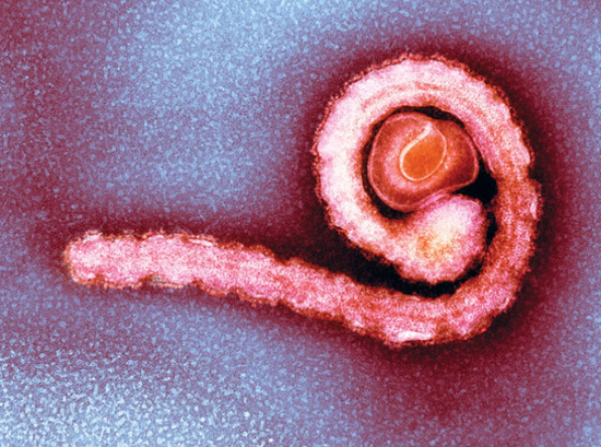 关于埃博拉的几点疑问