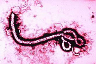 美国科学家研究发现埃博拉病毒弱点