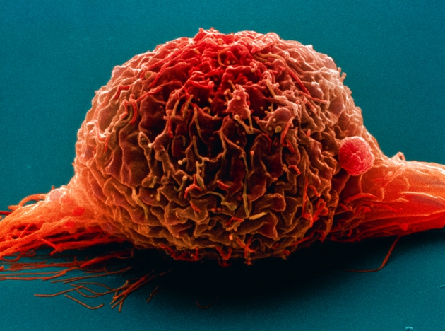 免疫系统为治疗癌症提供了新的线索