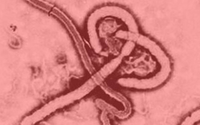 多种抗埃博拉病毒药物将相继开展临床试验