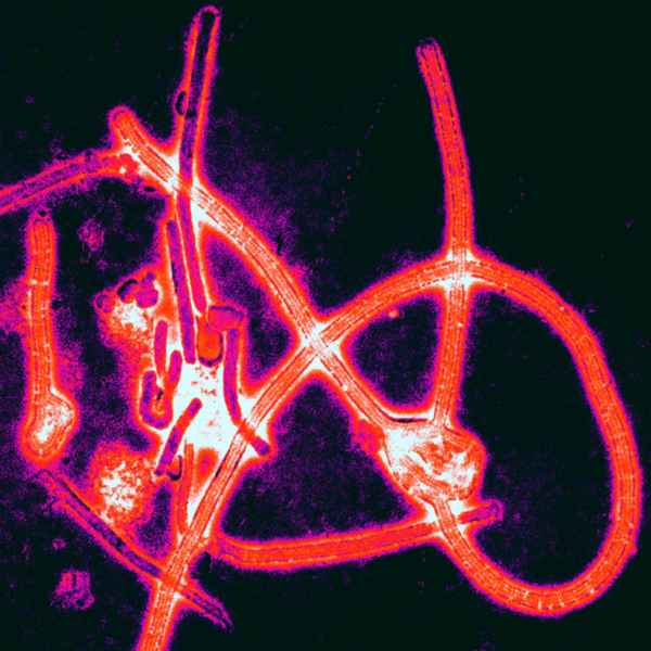 用于对抗埃博拉病毒的抗体有望治疗这种罕见的致命感染